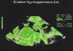 Embriyogenesis – Özlem Ada